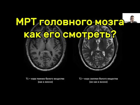 Видео: МРТ головного мозга, как его смотреть? Михаил Михайлович Берегов.