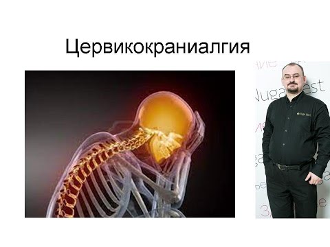 Видео: Цервикокраниалгия – головная боль вызванная проблемами в шее.
