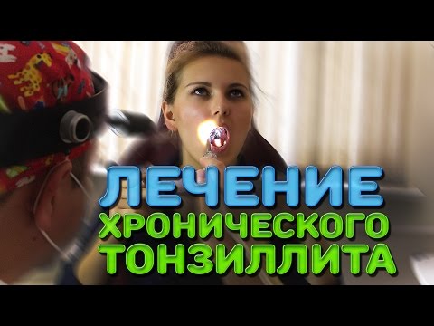 Видео: Лечение хронического тонзиллита | Лечим правильно с Владимиром Зайцевым