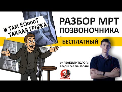 Видео: Сложные ситуации на разборах МРТ.