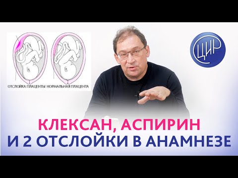 Видео: Поможет ли клексан или нужен аспирин, если был выкидыш на 14 неделе и 2 отслойки с кровотечением?