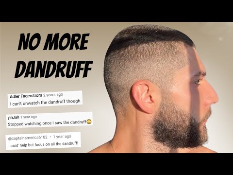Видео: 5 привычек, которые избавят вас от 90% перхоти и себорейного дерматита