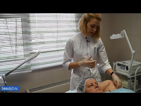 Видео: Решаем проблему повышенного потоотделения с помощью инъекций ботулотоксина