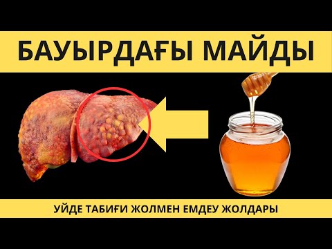 Видео: Бауыр ауруына қарсы ең тиімді тағамдар!