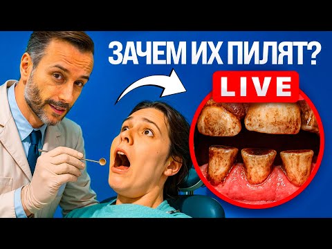 Видео: Зачем подпиливать зубы в ортодонтии? Стриппинг зубов