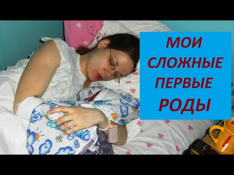 Видео: Мои СЛОЖНЫЕ первые РОДЫ// КРУПНЫЙ плод// СТИМУЛЯЦИЯ без ЭПИДУРАЛЬНОЙ анестезии//