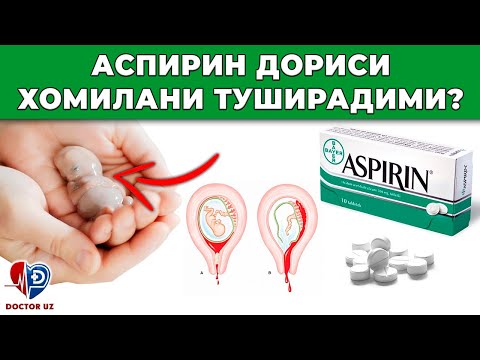 Видео: ДИҚҚАТ! АСПИРИН ДОРИСИ ХОМИЛАНИ ТУШИРАДИМИ😱😱