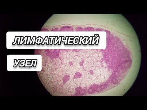 Видео: ЛИМФАТИЧЕСКИЙ УЗЕЛ