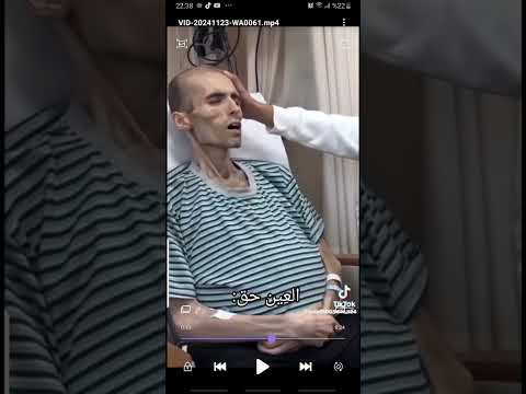 Видео: көзден сақ болыңыз