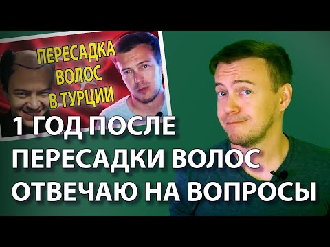 Видео: Год спустя после пересадки волос. Отвечаю на вопросы