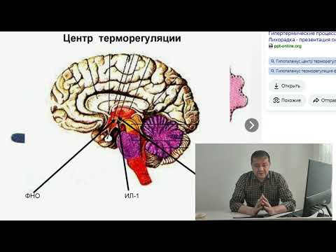Видео: мия ичи босими ошиши ( черепной давление) хакида .Ошадими ёки йукми . Сабаблари ва даволаниши кандай