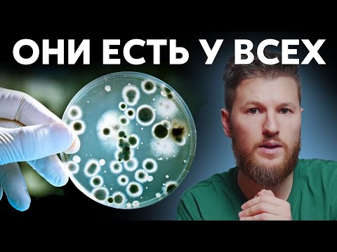Видео: ОНИ ЕСТЬ У ВСЕХ - Кандиды. Как избавиться от молочницы?