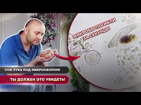 Видео: Что делает ЛУК с микробами под микроскопом?! 😱 Это просто ЖЕСТЬ!
