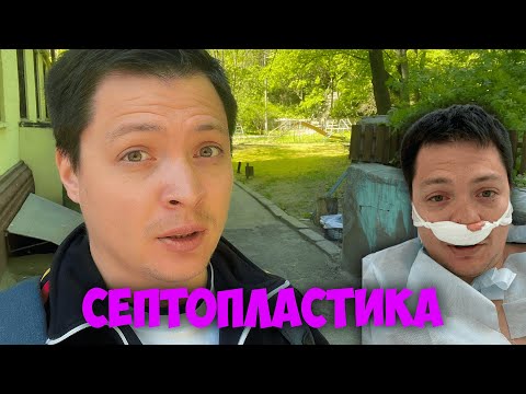 Видео: Септопластика - мой опыт. Делать или нет?