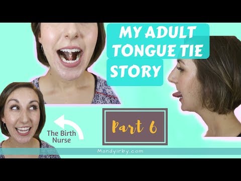 Видео: Как растянуться после рассечения уздечки языка у взрослых | Часть 6
