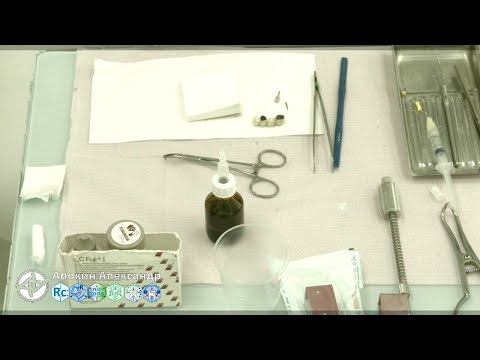 Видео: Подготовка к фиксации и замешивание Fuji I (ЗАС 002)(прямой эфир)