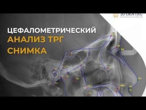 Видео: ТРГ, (Шварц бойынша Телерентгенография) қазақ тілінде
