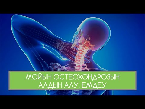 Видео: МОЙЫН АУРУЫ, ОСТЕОХОНДРОЗЫ АЛДЫН АЛУ, ЕМДЕУ!!!