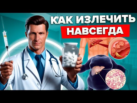 Видео: ЦИРРОЗ, ГЕПАТОЗ, ФИБРОЗ: Как стволовые КЛЕТКИ и OFO7788 могут СПАСТИ Вашу ПЕЧЕНЬ