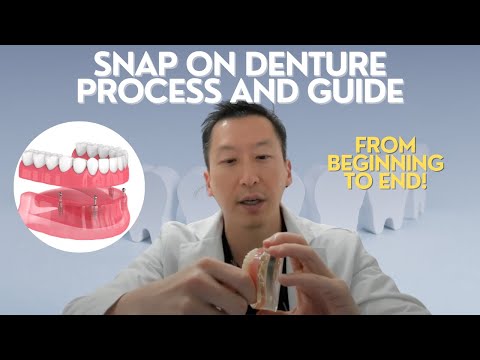 Видео: Шаги для установки зубного протеза