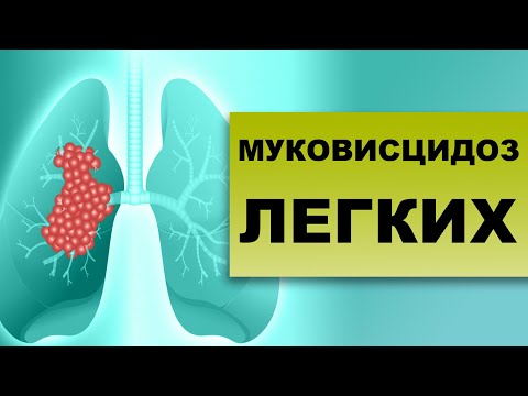 Видео: МУКОВИСЦИДОЗ. ЛЕЧЕНИЕ, СИМПТОМЫ, ДИАГНОСТИКА