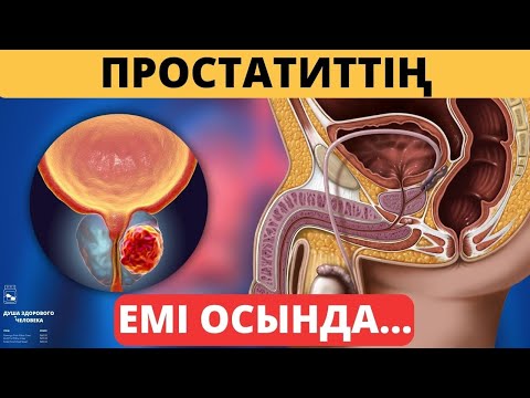 Видео: ЖАҚСЫ ЖАҢАЛЫҚ! Қуық асты безінің асқынуын дәрісіз ЕМДЕУ #қуықастыбезі