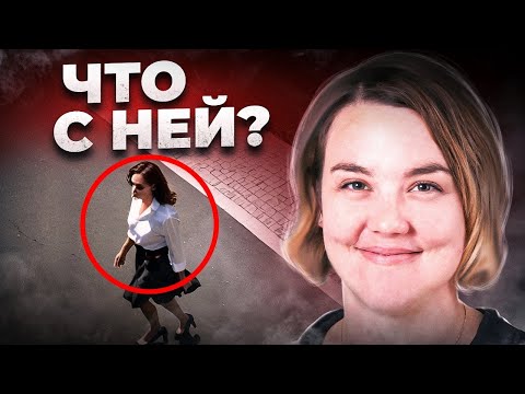 Видео: С этой девушкой произошло нечто ужасное. Безумная история Ханны Эпп