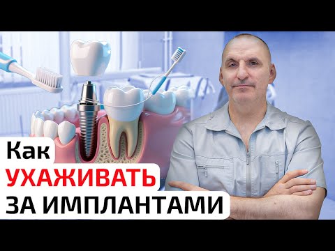 Видео: Как ухаживать за имплантами, чтобы они служили вечно?