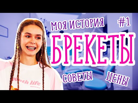 Видео: БРЕКЕТЫ – МОЯ ИСТОРИЯ. ГАЙД СО ВСЕМИ ЭТАПАМИ И ЦЕНАМИ ДЛЯ БУДУЩИХ БРЕКЕТОНОСЦЕВ.