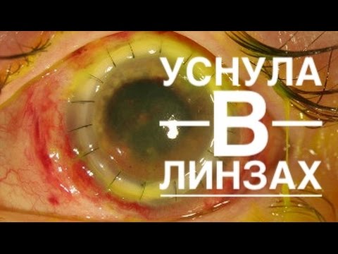 Видео: Что Если Уснуть В Линзах?