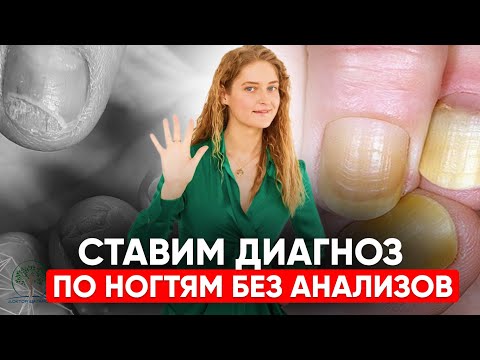 Видео: Китайский СПОСОБ узнать болезни по ногтям за 8 МИНУТ