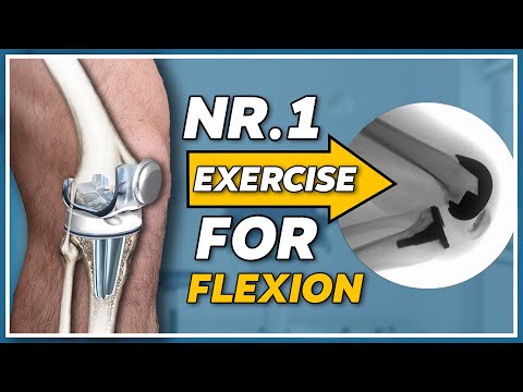 Видео: Упражнение № 1 для улучшения сгибания коленного сустава после его замены