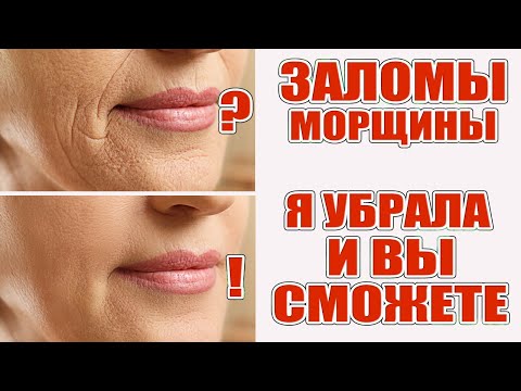 Видео: Убрала заломы. Легкие и недорогие решения!