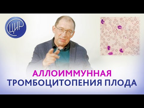 Видео: Аллоиммунная тромбоцитопения плода. Система HPA. Группы крови тромбоцитов. Анонс лекции для врачей.