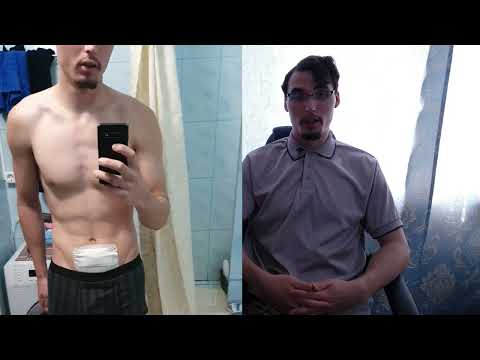 Видео: 10 месяц лечение акнекутаном