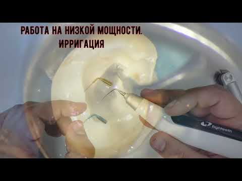 Видео: Обзор прибора Ultra-X