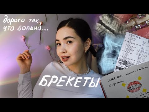 Видео: podsact: мой путь до брекетов