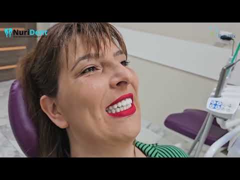 Видео: Йорданка има проблем с парадонтоза, кисти след консултация с Д-р Нури, тя избира системата BasalFix
