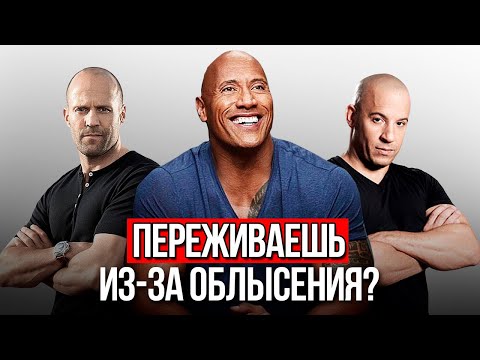 Видео: ОБЛЫСЕНИЕ, это ХАРИЗМА Или Комплекс? Почему девушки любят лысых?