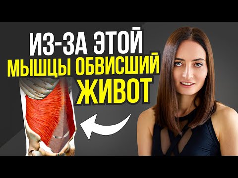 Видео: Выпирающий живот, недержание мочи, гиперлордоз, боли в пояснице и всё из-за ЭТОЙ мышцы
