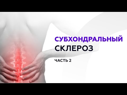 Видео: 2 часть. Врач-ортопед Мусин У.К. о субхондральном склерозе