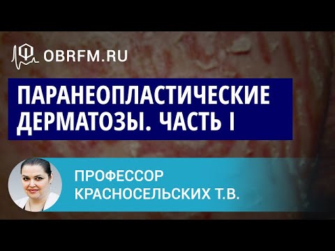 Видео: Профессор Красносельских Т.В.: Паранеопластические дерматозы. Часть I