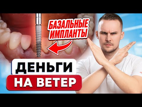 Видео: Никогда не ставьте такие импланты. Базальная имплантация
