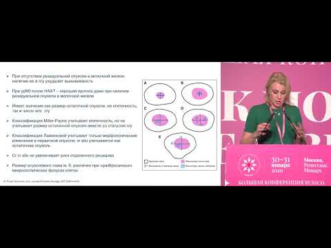 Видео: Оценка ответа опухоли на лечение по системе RCВ, кому и зачем?