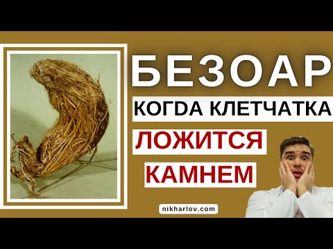 Видео: БЕЗОАР желудка и кишечника. ХУРМА ➡ ФитоБезоар. Поедание волос ➡ ТрихоБезоар. Причины, Факторы риска