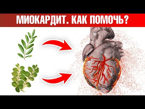 Видео: 5 натуральных средств от миокардита👍