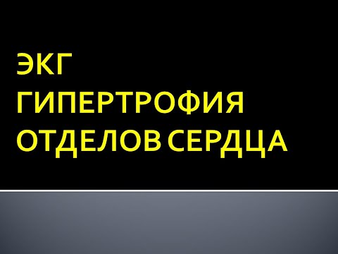 Видео: ЭКГ. Гипертрофия отделов сердца. Павлова Н. П.