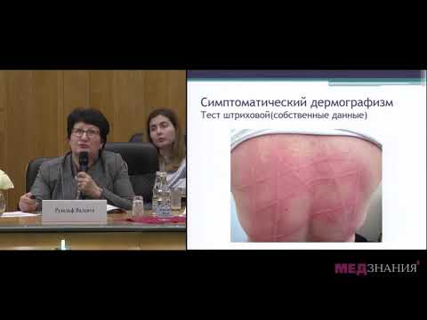 Видео: 9. Хронические индуцированные крапивницы. Р.Я. Мешкова