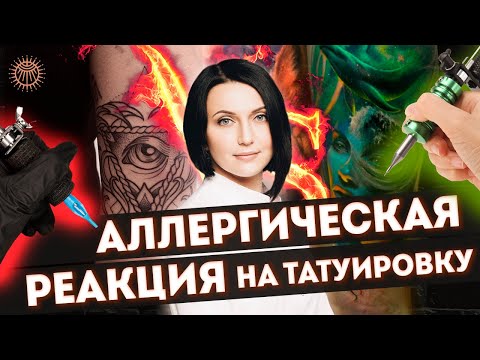 Видео: Аллергия на тату