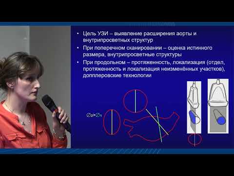 Видео: Ультразвуковое исследование в диагностике аневризмы брюшного отдела аорты, Саратова А.К.